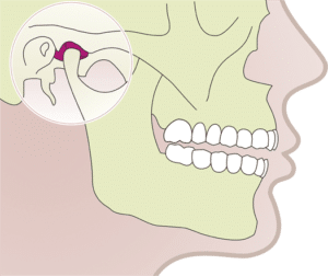 articulación-temporo-mandibular