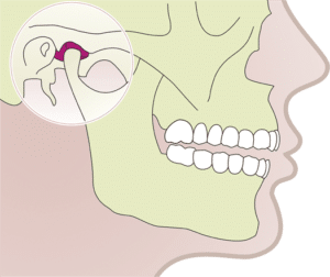 articulación-temporo-mandibular