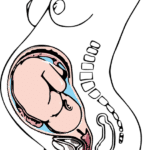 fisioterapia-del-parto