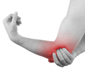 epicondilitis
