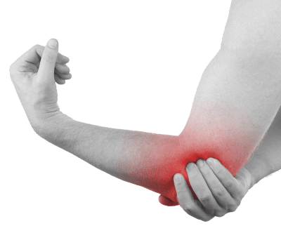 epicondilitis
