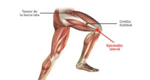 Rodilla_del_corredor