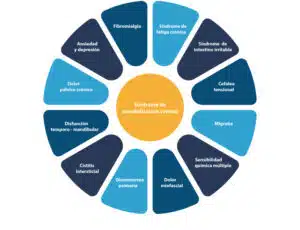 Sindrome_de_sensibilizacion_central