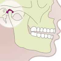 articulacion-temporo-mandibular articulación-temporo-mandibular